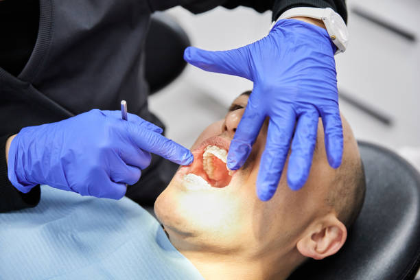 Best Teeth Whitening  in Elyria, OH